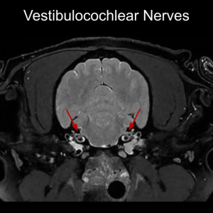 vestibulocochlearnervesslide.png
