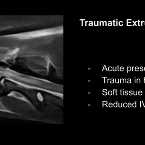 traumadiscslide.png