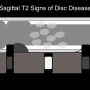 sagt2signsofivddnolabels.png