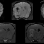 braintumorallseq.png