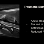 traumadiscslide.png