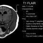 t1_flair_profile.png