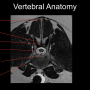 vertebralanatomyslide.png