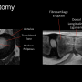 discanatomyslide.png