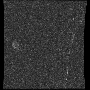 myelo_arachnoid_web.gif