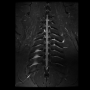 dorthoracicnorm.png