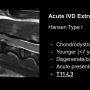 acuteivdslide.png