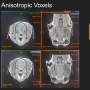 isotropic_vs_anisotropic_voxels.png