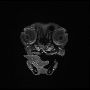 hemangio_t1fs_c.gif
